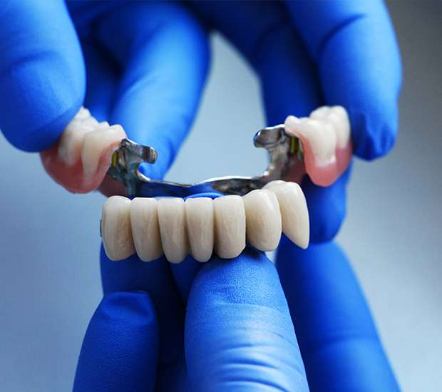 Brea Dental Bridges