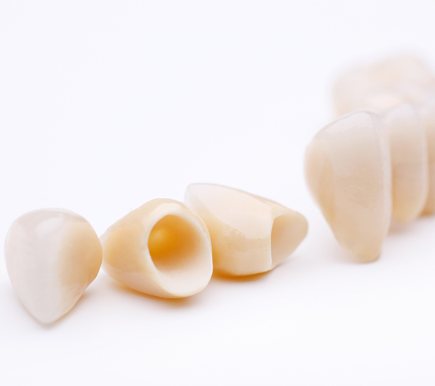 Brea Dental Crowns and Dental Bridges