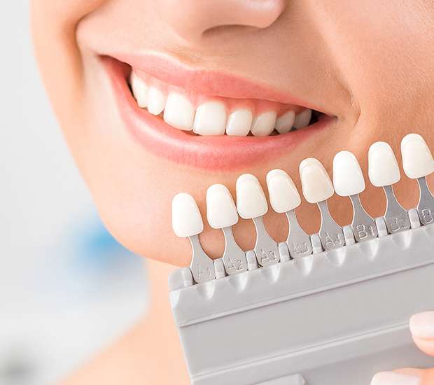 Brea Dental Veneers and Dental Laminates