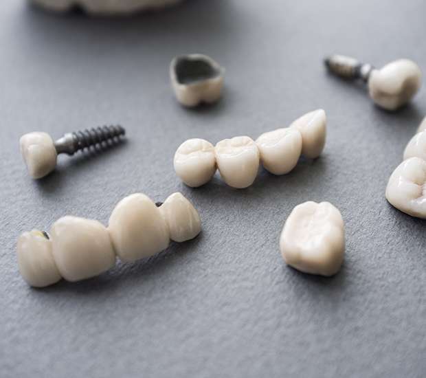 Brea The Difference Between Dental Implants and Mini Dental Implants
